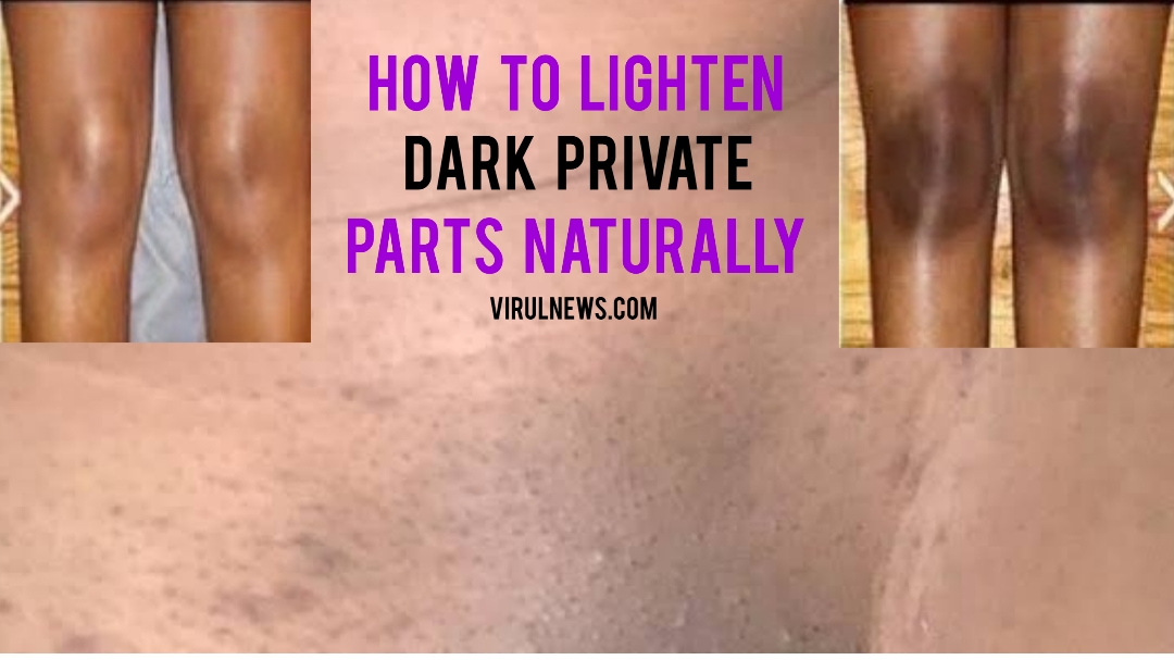 How to lighten dark private parts naturally?