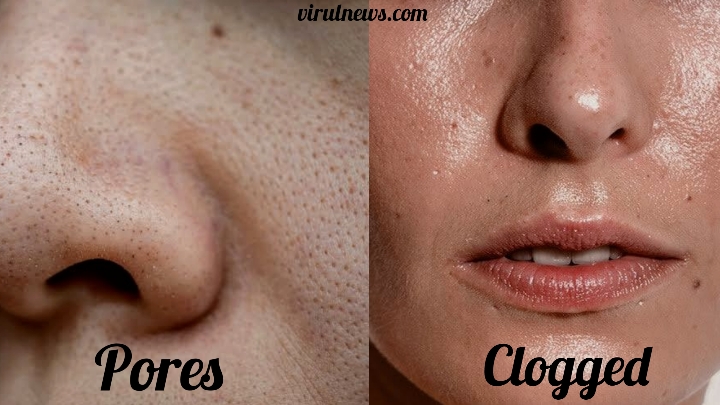 Different Between pores and clogged