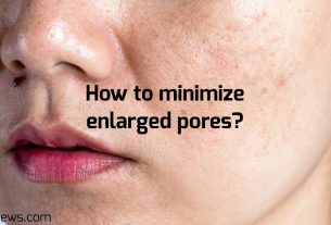 How to minimize enlarged pores?