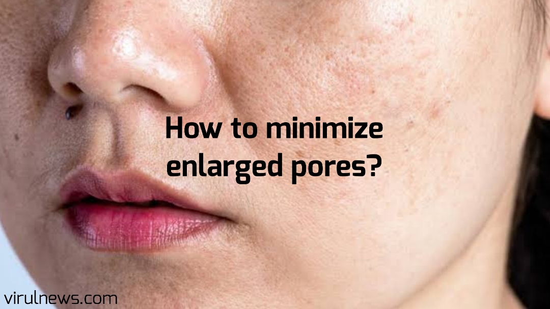 How to minimize enlarged pores?