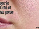 how to get rid of open pores on your face