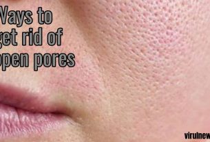 how to get rid of open pores on your face