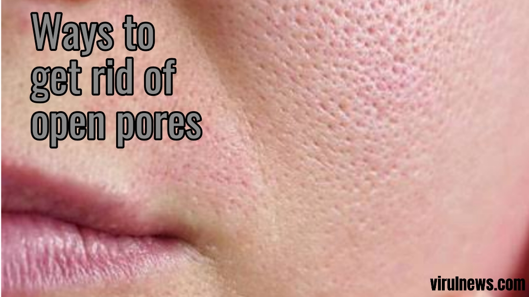 how to get rid of open pores on your face