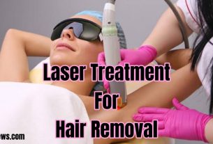 Laser treatment for hair removal.