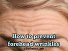 How to prevent forehead wrinkles and fine lines?