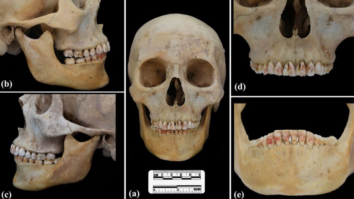 2200 -year -old Chinese burial unveils women with poisonous red stained teeth